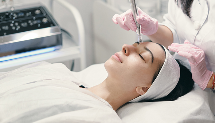 Microneedling